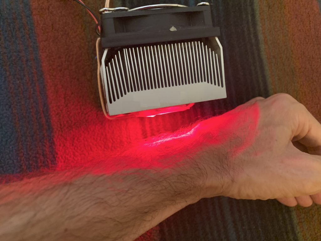 Light Therapy Example of Wrist