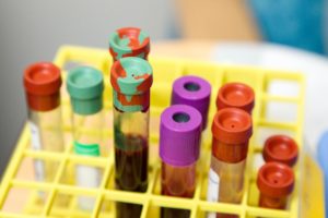 Read more about the article When Laboratory Testing Is Wrong: Sometimes We Trust Our Test Results Too Much