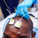 Transcranial Direct Current Stimulation for Depression