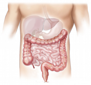 Read more about the article Small Intestinal Bacterial Overgrowth (SIBO) Treatment
